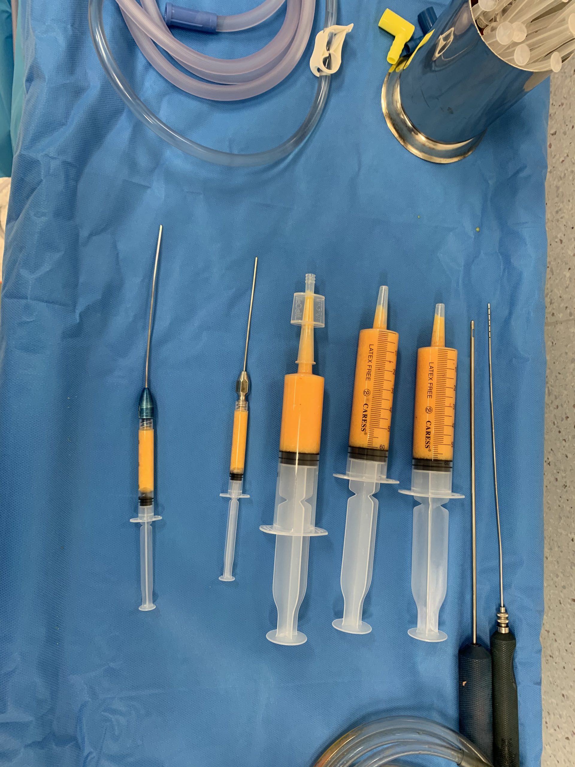 Lipofilling-Grasa-para-aumento-mamario