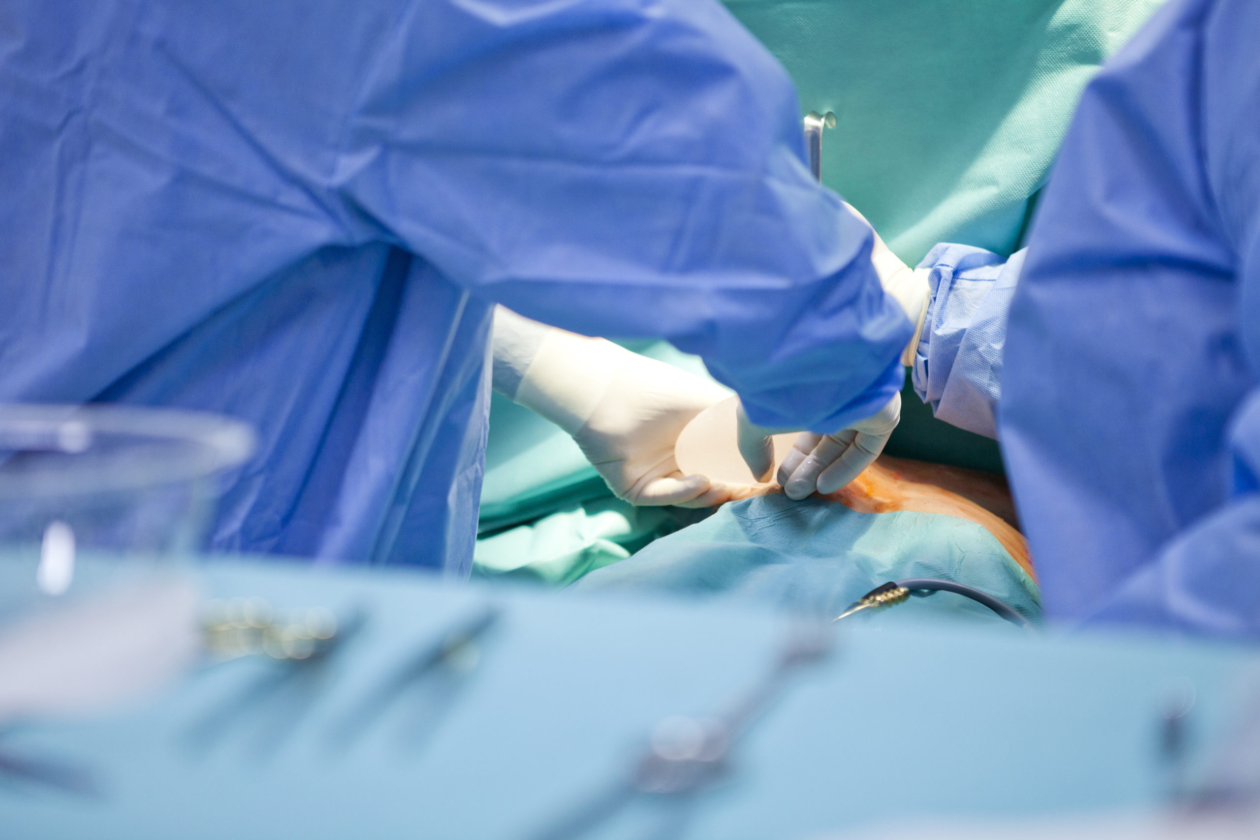 operación de pecho, mamopalstia